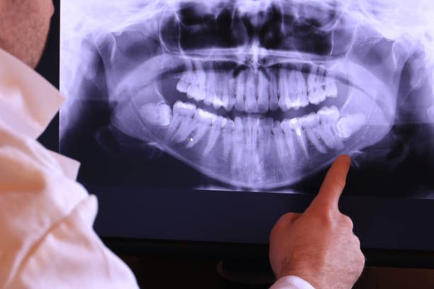 Best Emergency Care for Gum Disease in St James, MO